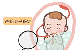 自贡孕期亲子鉴定需要怎么做，自贡怀孕亲子鉴定准确吗