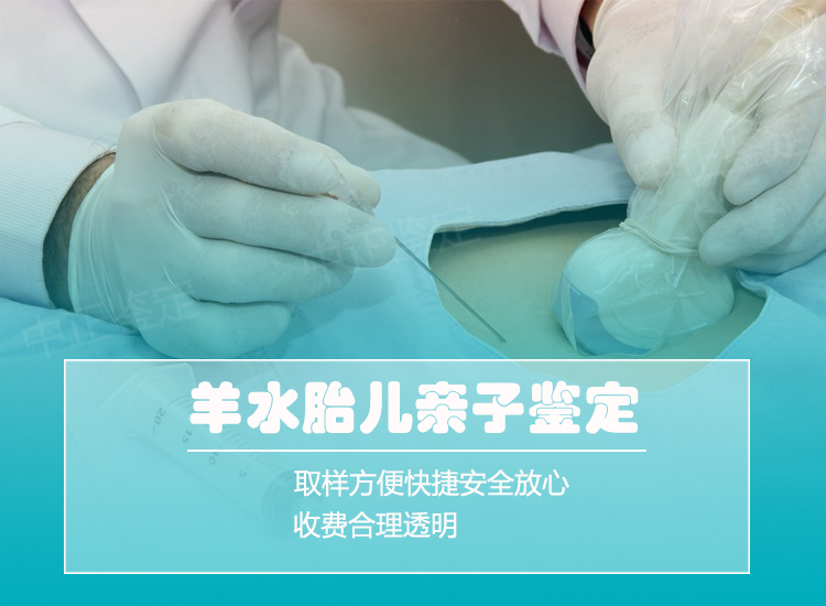 自贡羊水孕期亲子鉴定